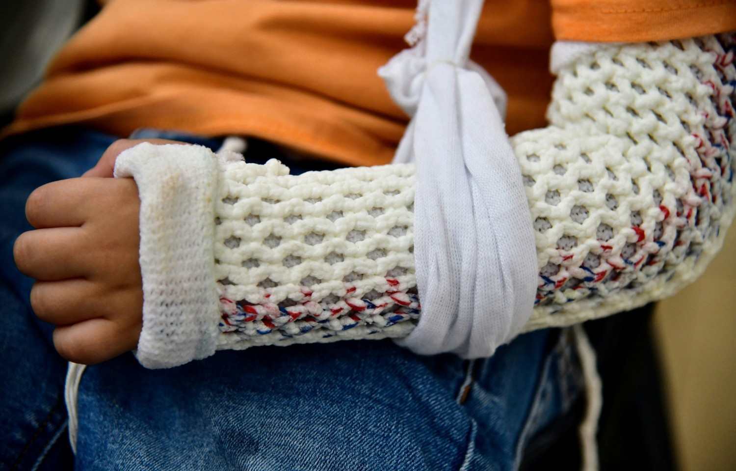 Brazo enyesado con vendaje